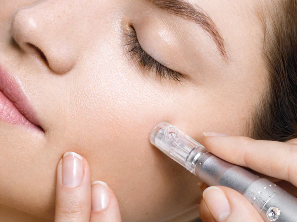 microneedling1_600x600